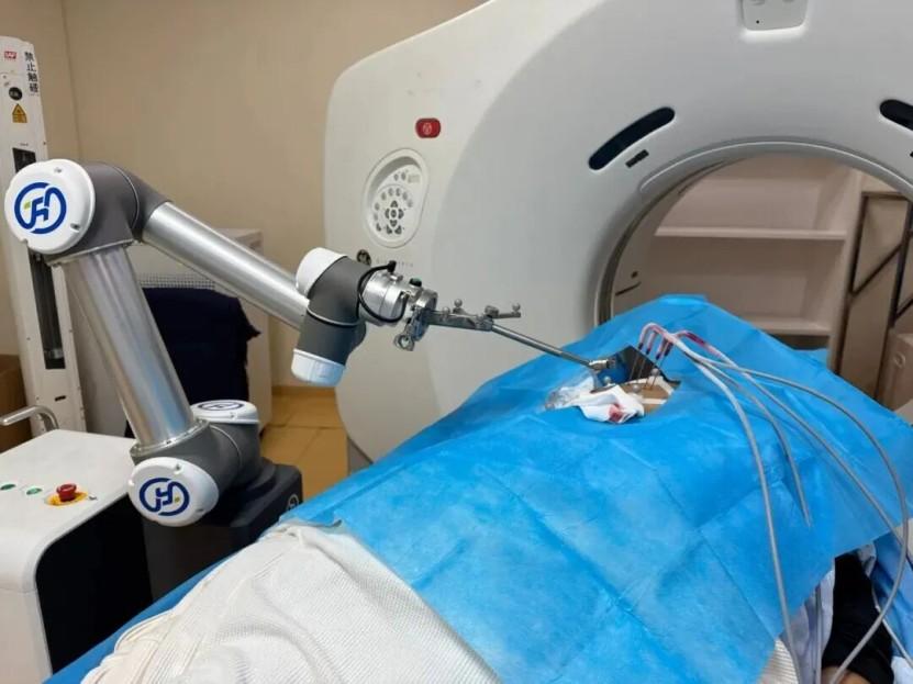 超5000例手术背后:穿刺机器人如何成为手术机器人“第四极”